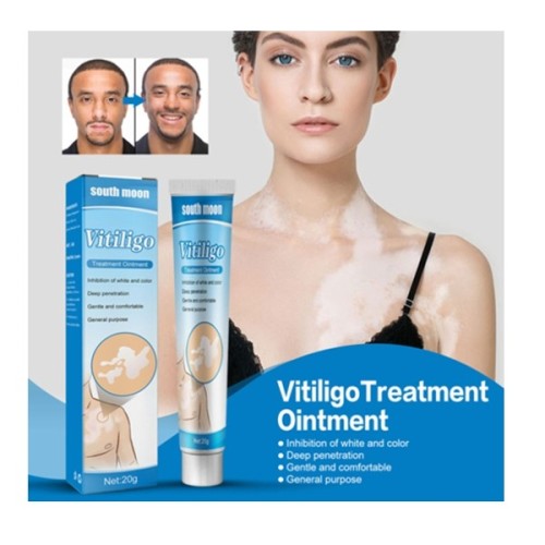South Moon Vitiligo Treatment Cream